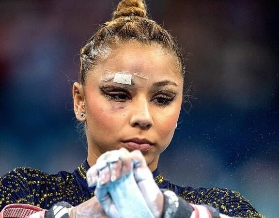 Why Flavia Saraiva Competed at the Olympics with a Bandaged Face – Top 3 Gymnast Injuries This Year.